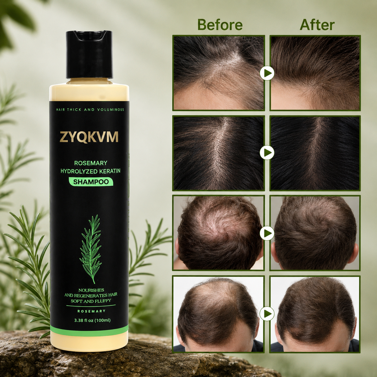 🔥LAST DAY 50% OFF - 🌿Loveherwm® Organic Rosemary Hair Growth Shampoo