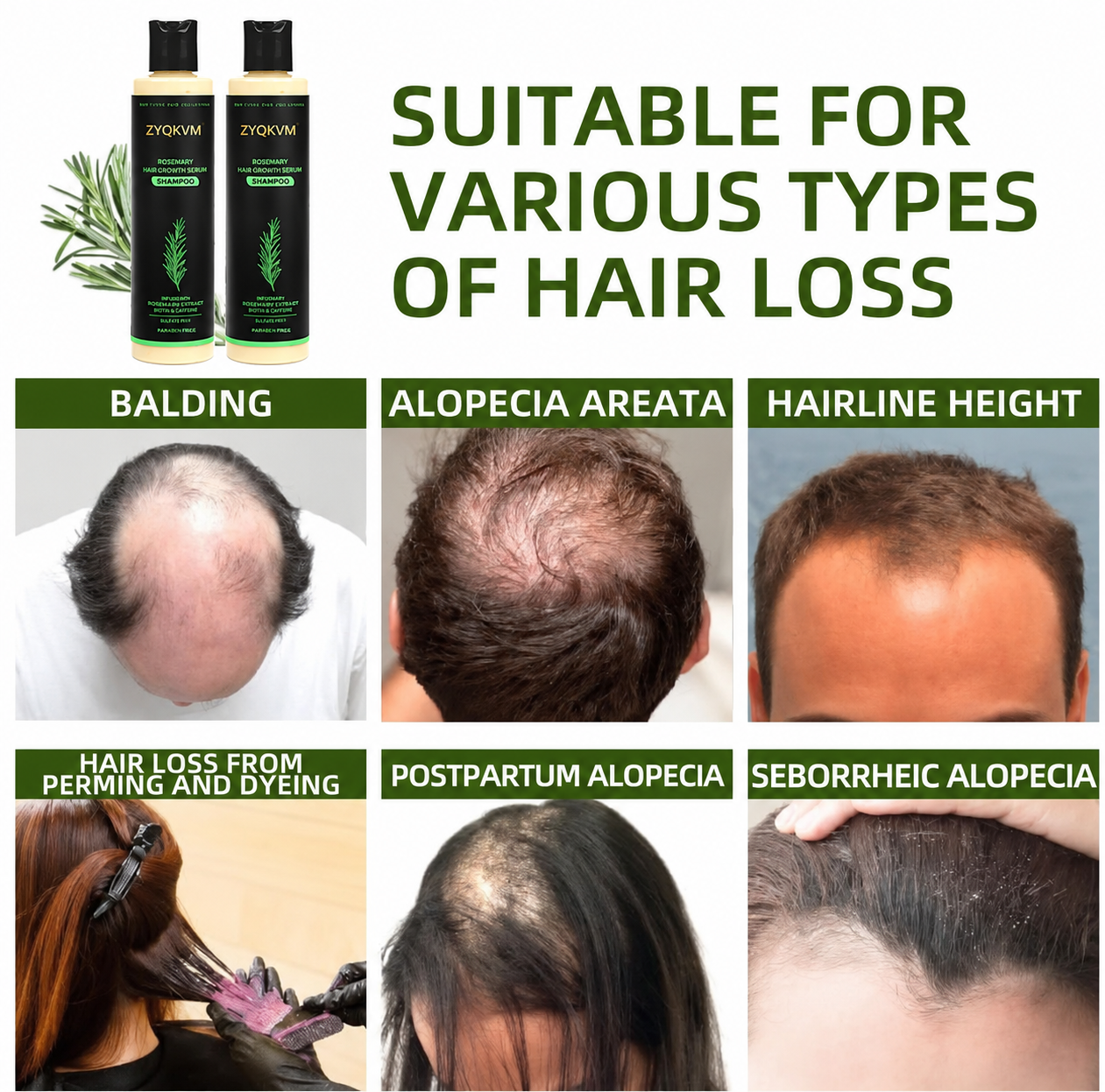 🔥LAST DAY 50% OFF - 🌿Loveherwm® Organic Rosemary Hair Growth Shampoo