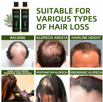 🌿ZYQKVM® Organic Rosemary Hair Growth Shampoo-🔥LAST DAY 50% OFF
