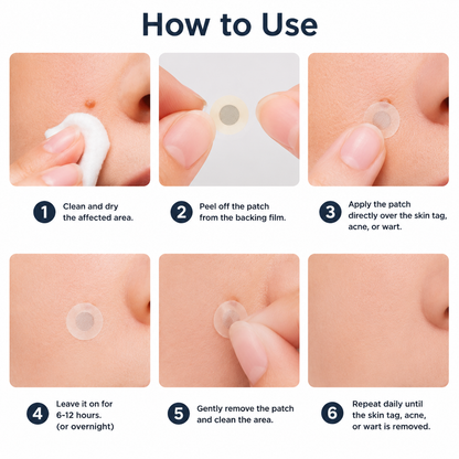 ✨LOVEHERWM®2-in-1 Microneedle & Hydrocolloid Patch🍀| Removes Raised Moles, Acne, Flat Warts & Skin Tags | Helps Improve Wrinkles, Scars & Blemishes | Invisible Patches for Face & Body