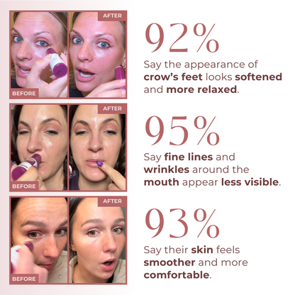 🔥LAST DAY 60% OFF - Loveherwm-Collagen Multi Balm Stick for Face, Eye & Neck Firming Care