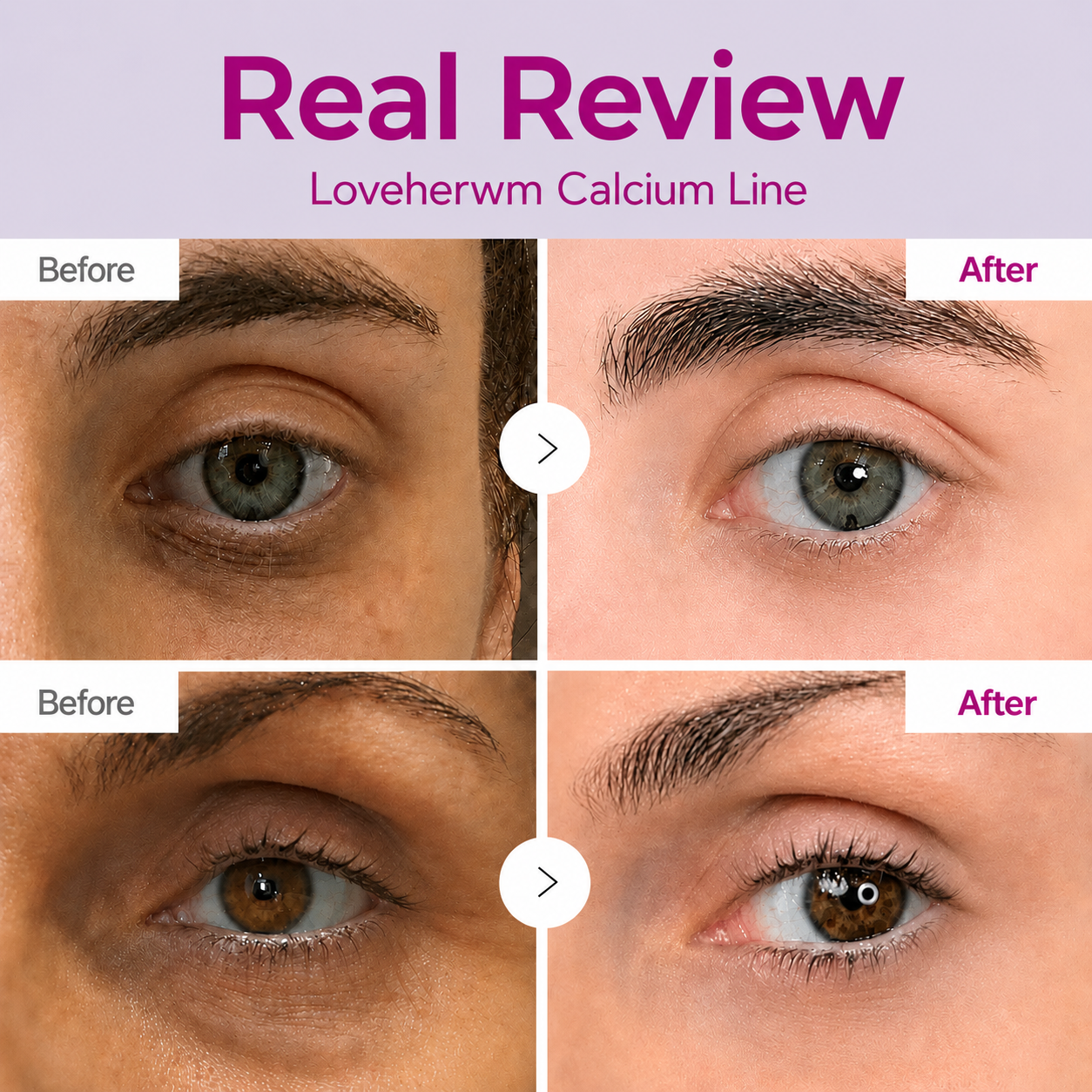 🔥LAST DAY 50% OFF!! Loveherwm Korean Calcium Dark Spot Eye Cream