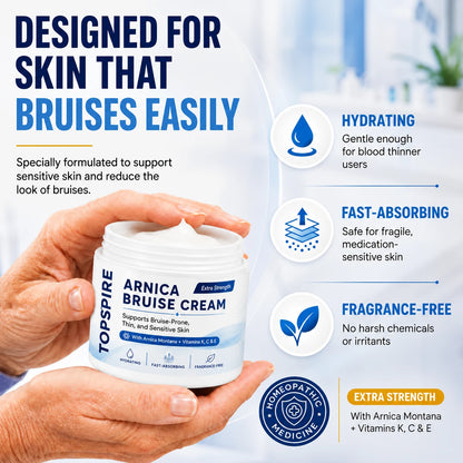 💥75K+ SOLD💕 TOPSPIRE® Arnica Bruise Cream - Repair Bruises & Strengthen Fragile Skin