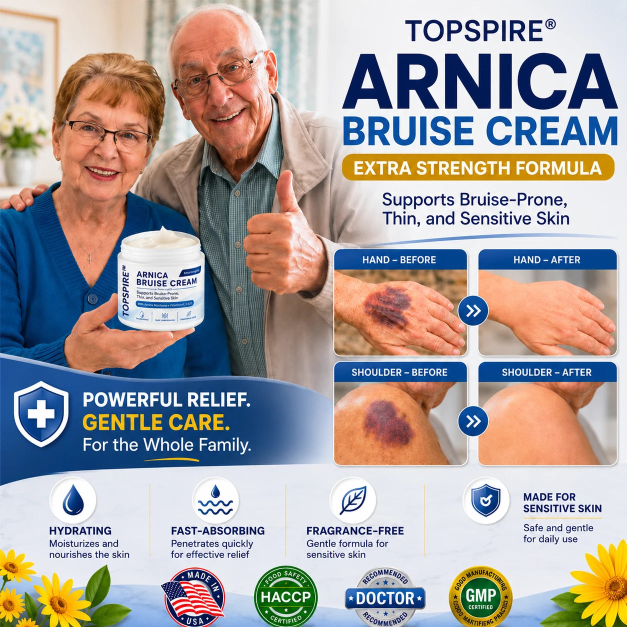 💥75K+ SOLD💕 TOPSPIRE® Arnica Bruise Cream - Repair Bruises & Strengthen Fragile Skin