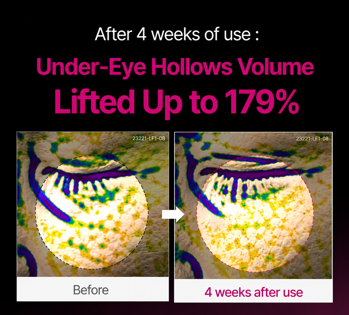 🔥LAST DAY 50% OFF!! Loveherwm Korean Calcium Dark Spot Eye Cream
