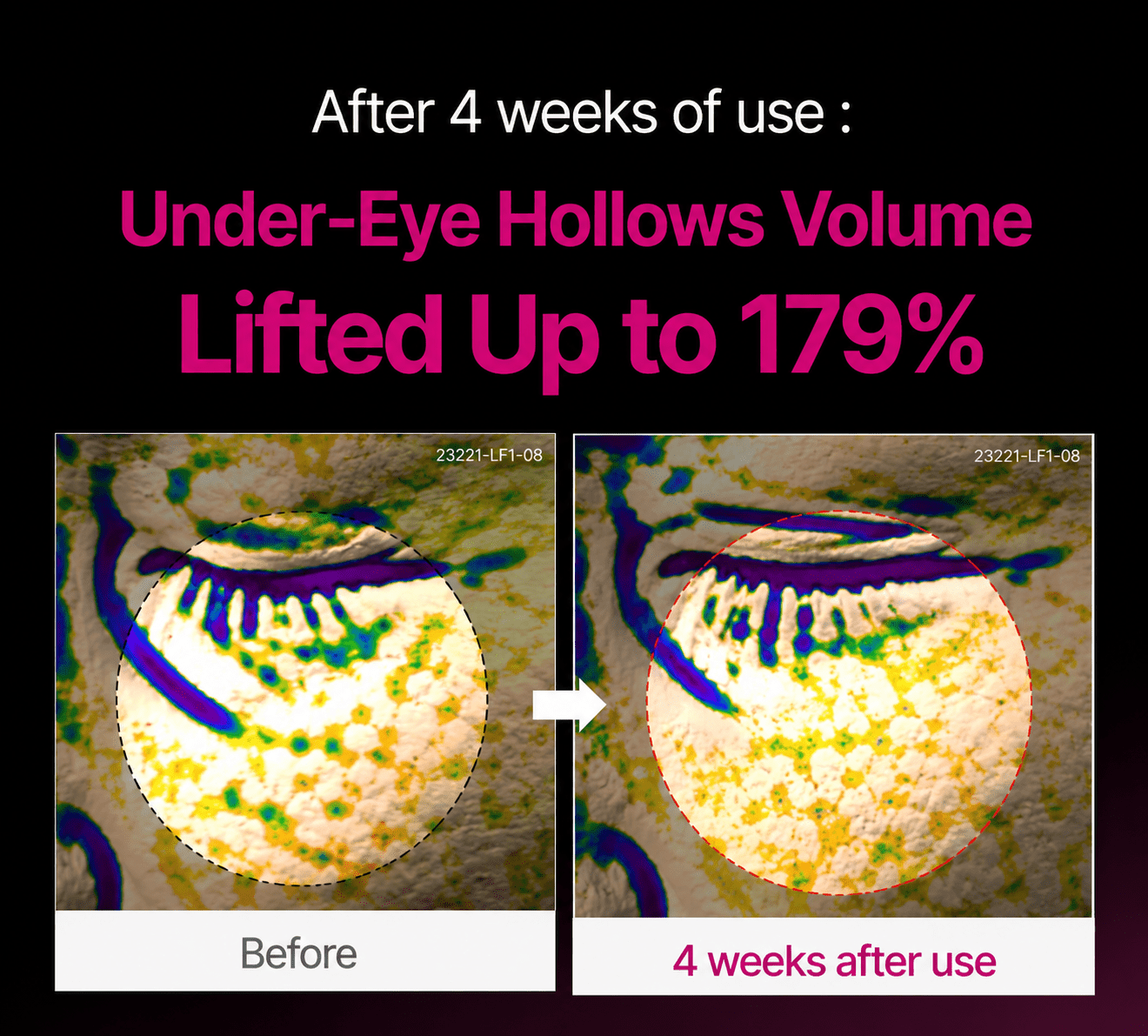 🔥LAST DAY 50% OFF!! Loveherwm Korean Calcium Dark Spot Eye Cream - Loveherwm