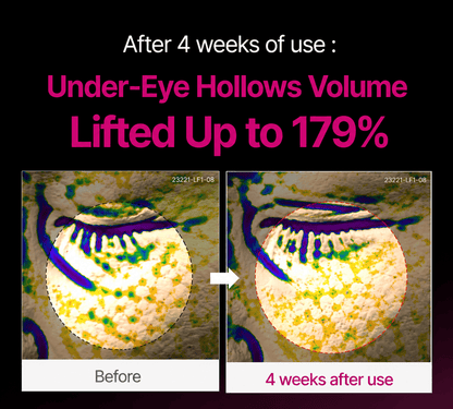 🔥LAST DAY 50% OFF!! Loveherwm Korean Calcium Dark Spot Eye Cream - Loveherwm