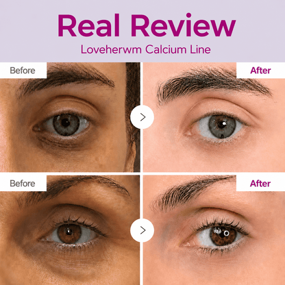 🔥LAST DAY 50% OFF!! Loveherwm Korean Calcium Dark Spot Eye Cream - Loveherwm