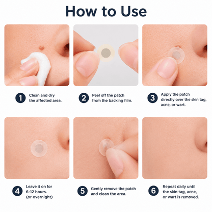 ✨LOVEHERWM®2-in-1 Microneedle & Hydrocolloid Patch🍀| Removes Raised Moles, Acne, Flat Warts & Skin Tags | Helps Improve Wrinkles, Scars & Blemishes | Invisible Patches for Face & Body - Loveherwm